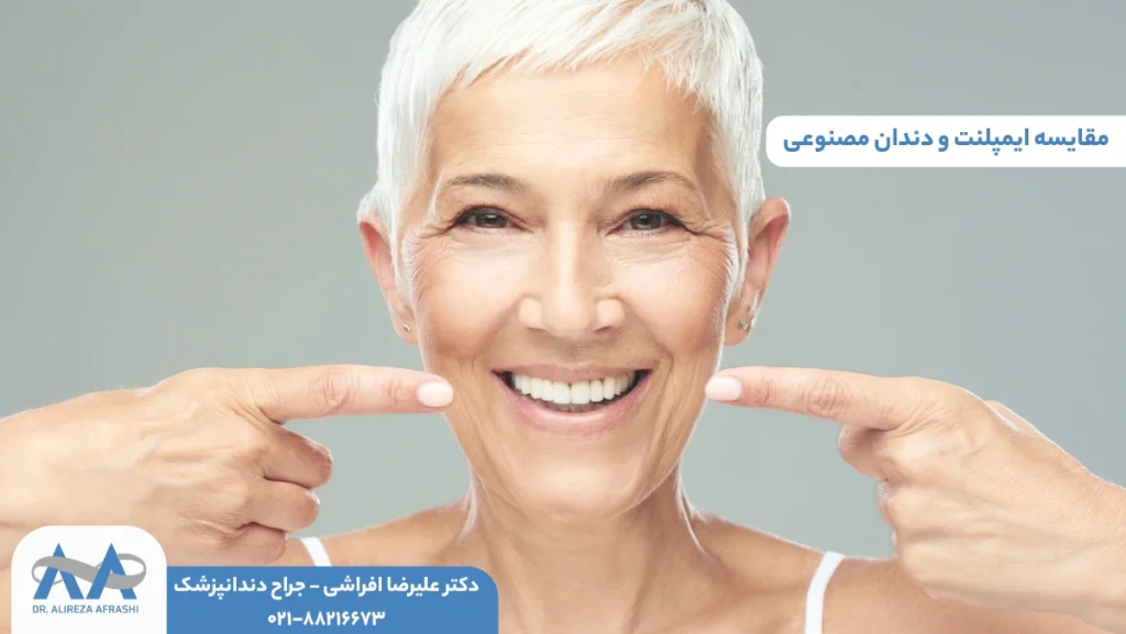مقایسه ایمپلنت و دندان مصنوعی