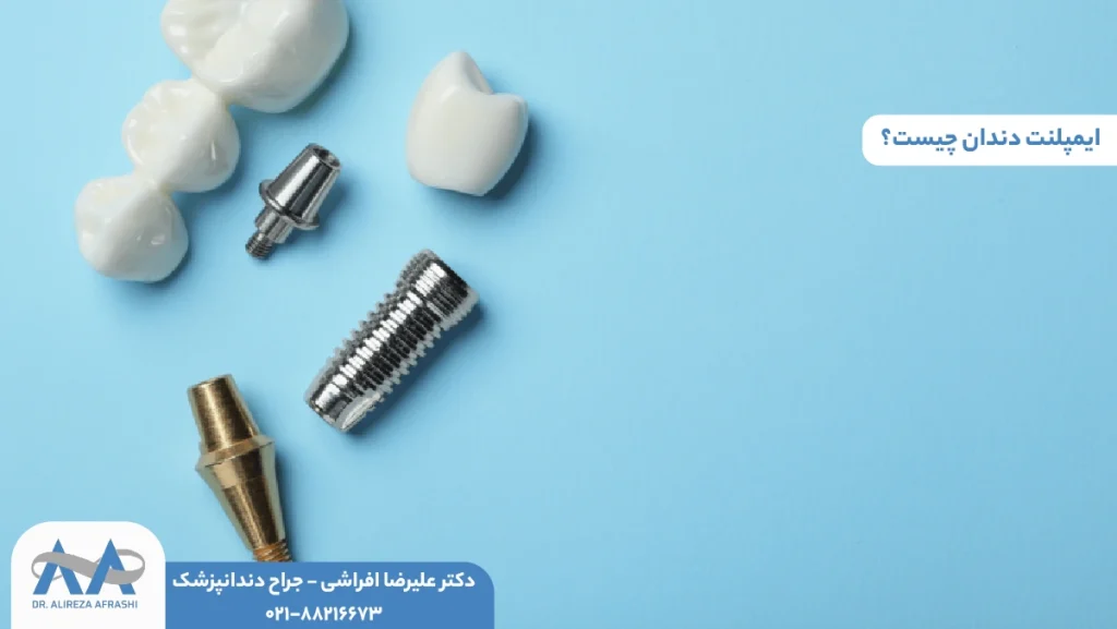 ایمپلنت دندان چیست