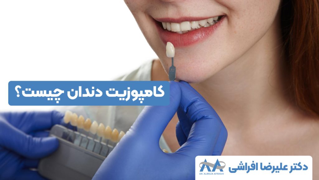 کامپوزیت دندان چیست؟