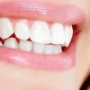 راه‌ های طبیعی برای افزایش زیبایی دندان‌ ها