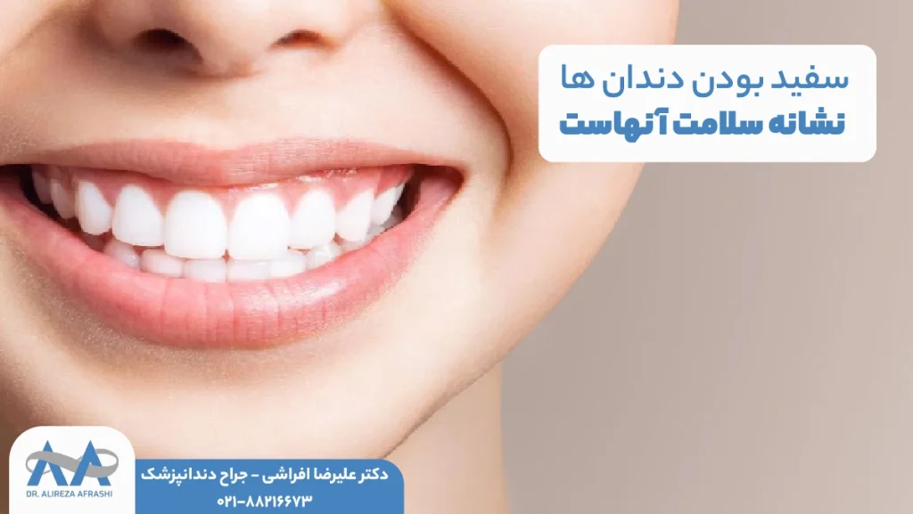 سفید بودن دندان‌ ها نشانه سلامت آنهاست