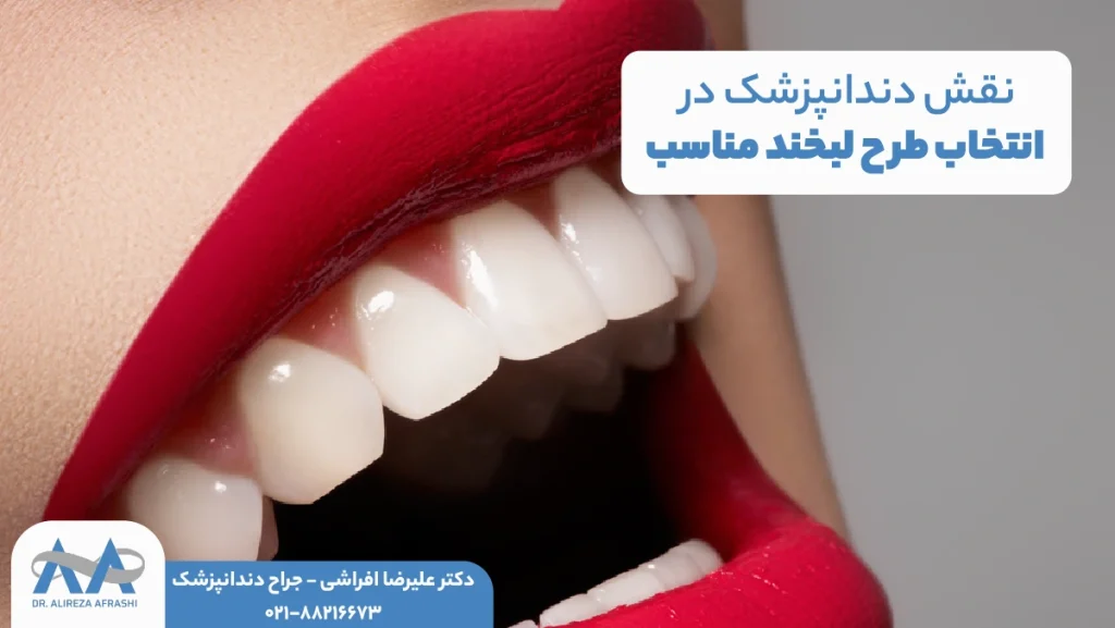 نقش دندانپزشک در انتخاب طرح لبخند مناسب