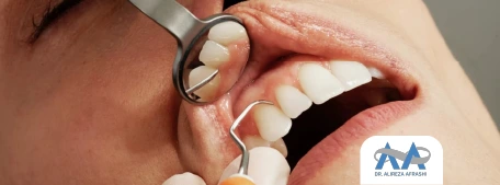 چند وقت یک‌بار باید به دندانپزشک مراجعه کنیم؟-01