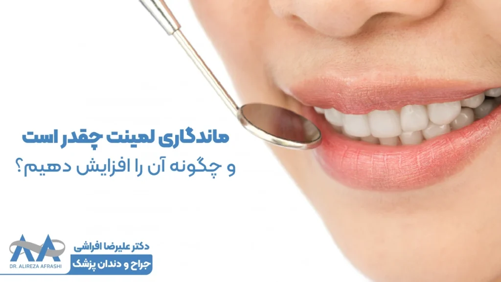 ماندگاری لمینت چقدر است و چگونه آن را افزایش دهیم؟